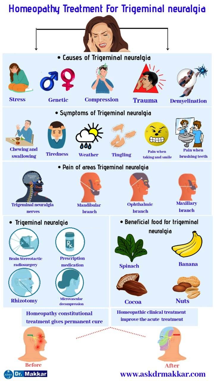 Trigeminal Neuralgia Homeopathic Treatment Fascial Pain During Eating Chewing Speaking India ...